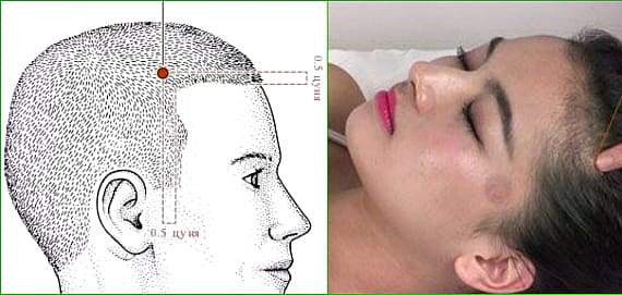 Точковий масаж при головному болі: як зняти біль, на які точки натискати