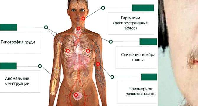 Тестостерон у жінок: підвищений або знижений, на що впливає