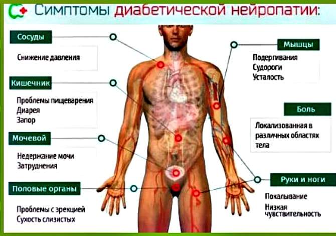 Як лікувати діабетичну нейропатію народними методами