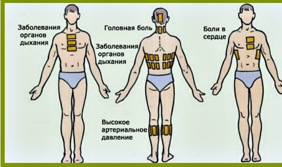 Як ставити гірчичники дітям і дорослим