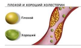 Що таке «поганий» і «хороший» холестерин в крові?