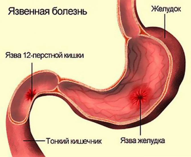 Як і для чого потрібно пити оливкову олію натщесерце?