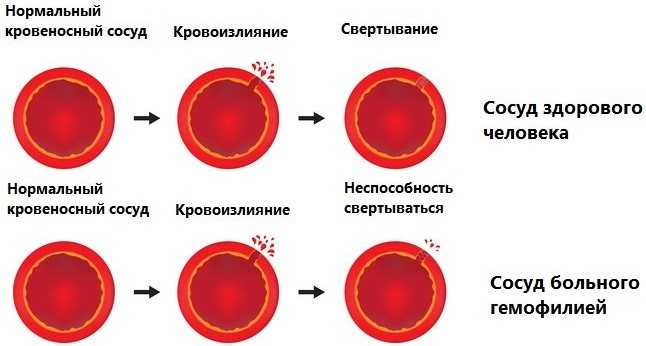 Рослинні флавоноїди - навіщо потрібні і в чому містяться