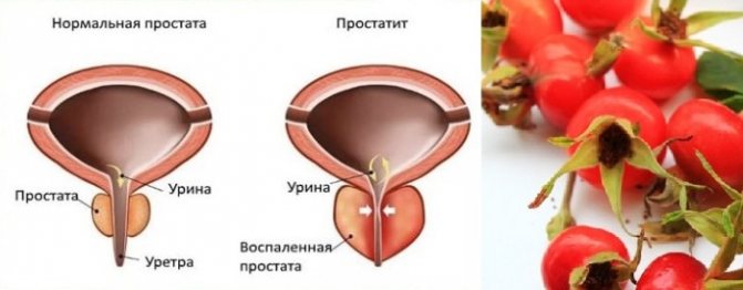 Шипшина для здоров'я чоловіка: корисні властивості та протипоказання