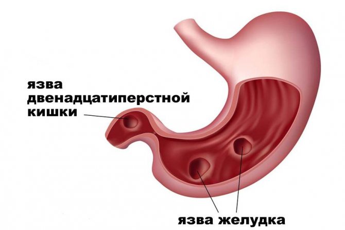 Кисле молоко: користь чи шкода для організму, застосування в народній медицині і косметології