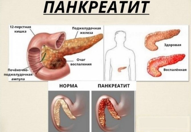 М'ясо нутрії користь - протипоказання до застосування, корисні властивості і особливості вживання (110 фото і відео)