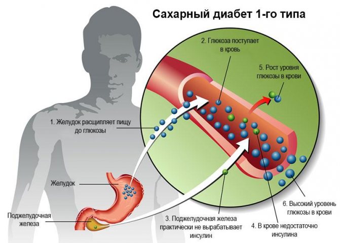 Чи потрібно пити «Боржомі»? Мінералка - це взагалі корисно або шкідливо? Важливі питання про мінеральну воду