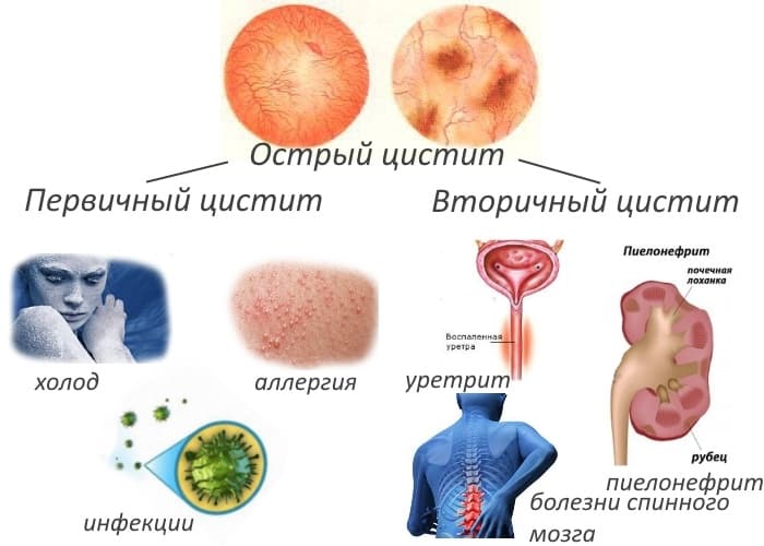 Чи потрібно пити «Боржомі»? Мінералка - це взагалі корисно або шкідливо? Важливі питання про мінеральну воду