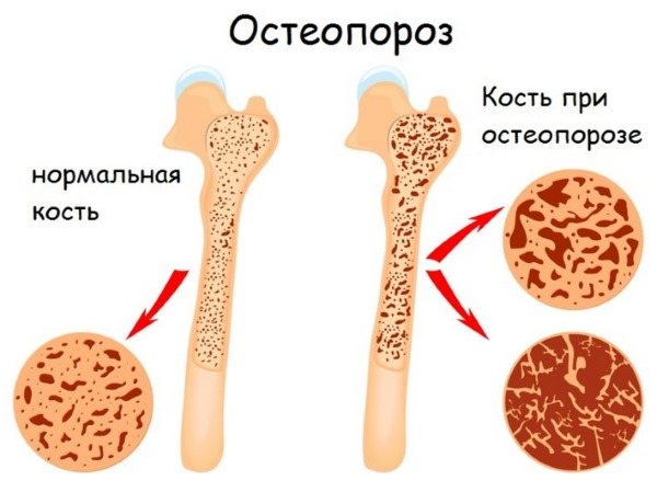 Що таке амарантового борошно і в чому її користь для схуднення?