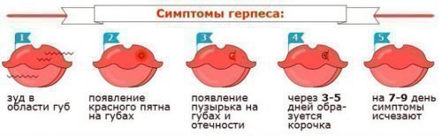 Період розвитку герпесу на губах