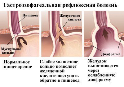 Проблема запаху крові в роті