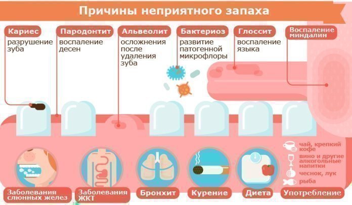 Засоби і методи позбавлення від поганого запаху з рота