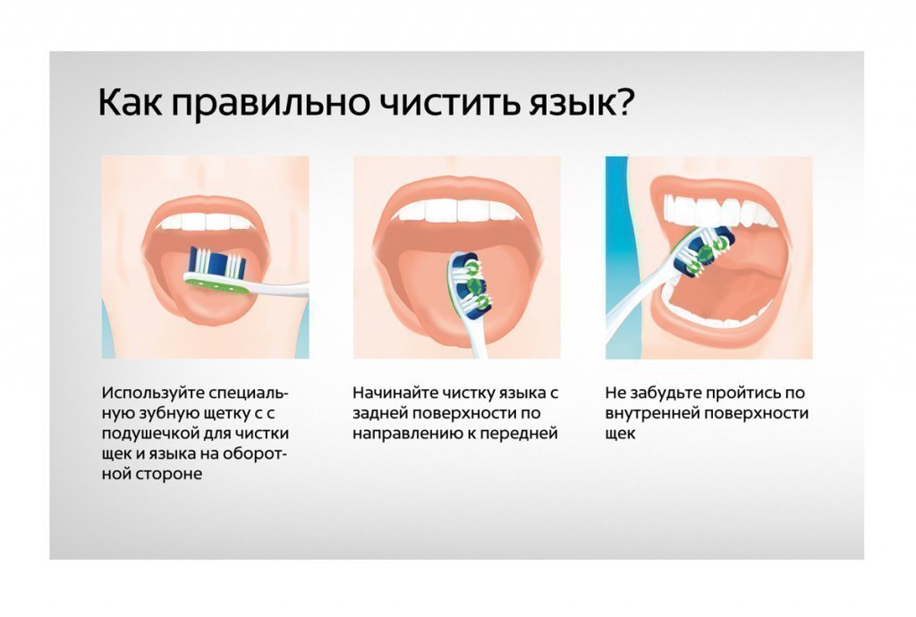 Чому на кінчику язика з'являється почервоніння