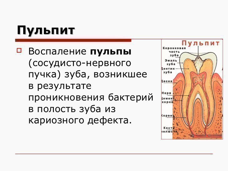 Причини ускладнень карієсу