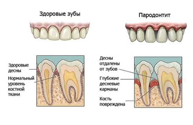 Що робити, якщо хитаються зовні здорові зуби