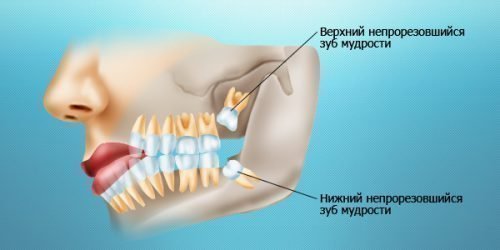 Що робити, якщо хитаються зовні здорові зуби