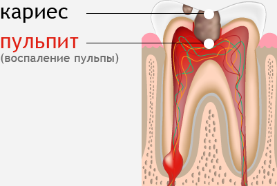 Які існують методи диференціальної діагностики карієсу