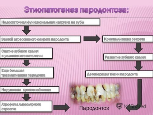 Застосування народної медицини в лікуванні пародонтозу